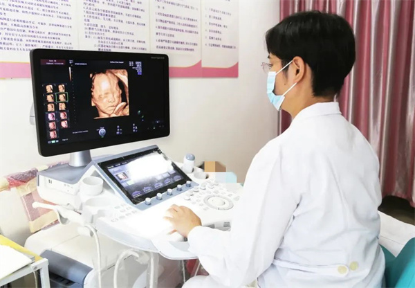 系统（四维）超声 护航胎儿健康